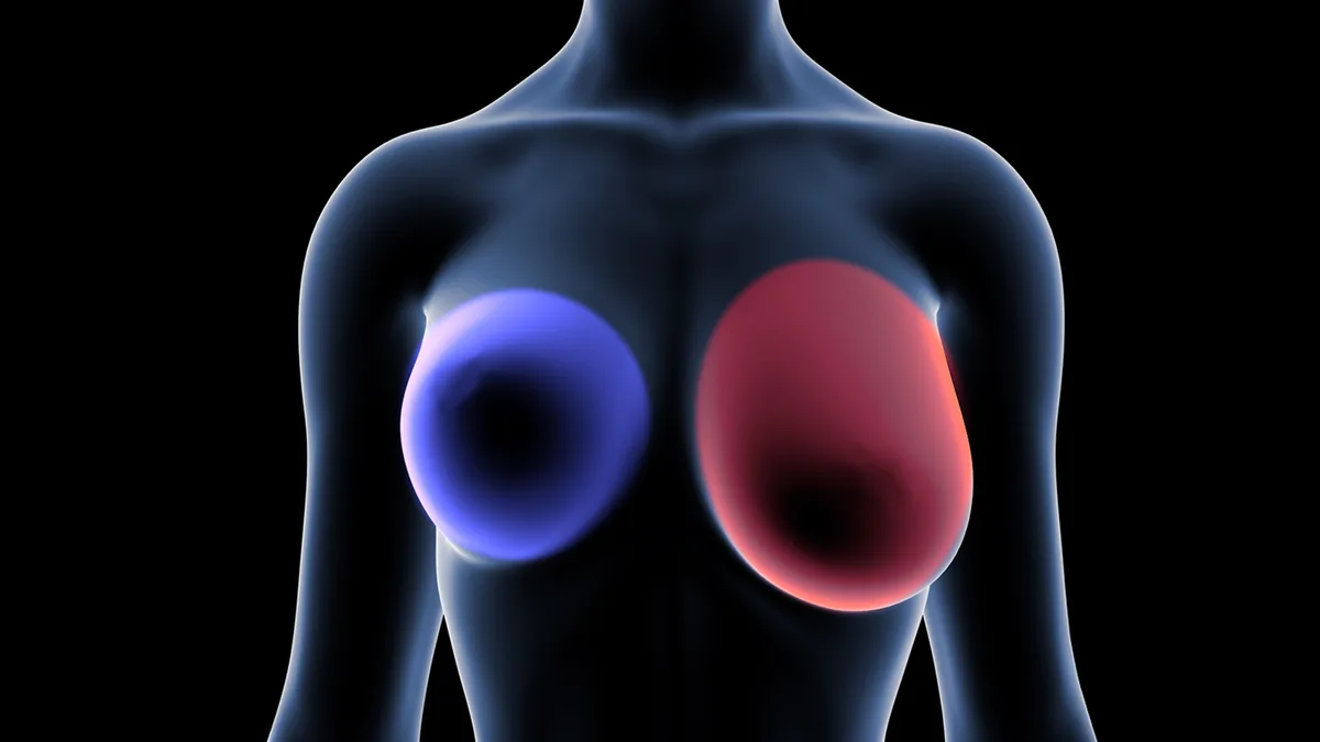 1 año antes del cáncer de mama, tu cuerpo te da señales