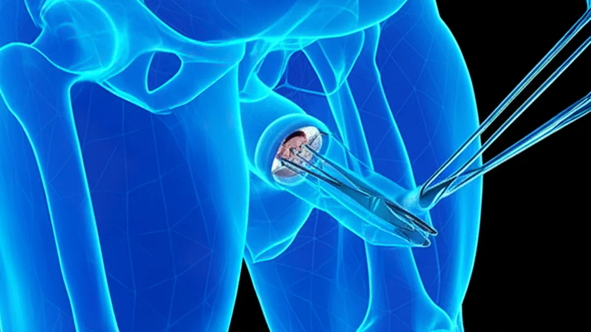 3 datos de la circuncisión que toda mujer debe saber