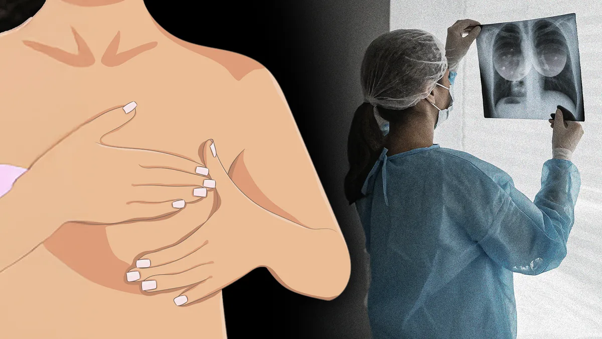 3 datos sobre el cáncer de mama que toda mujer debe saber