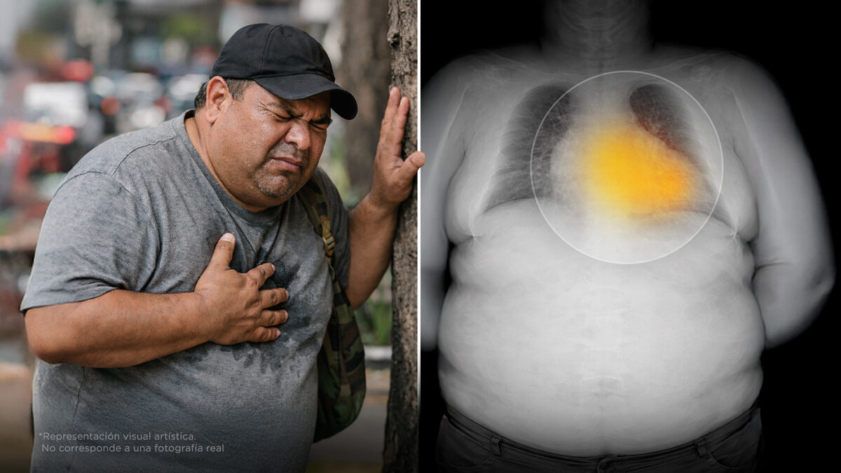 Antes de un infarto, tu cuerpo manda estas 3 señales