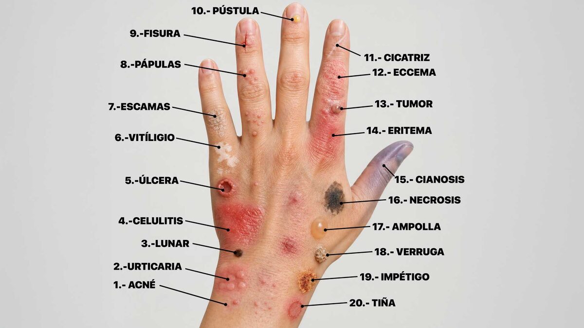 Aprende a identificar enfermedades en la piel antes de que sea tarde