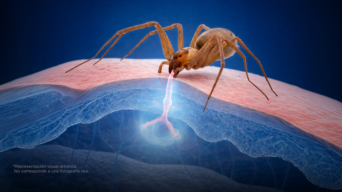 ¿Cómo sobrevivir a la picadura de una araña violinista?