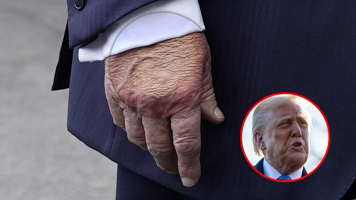 ¿De qué está enfermo Donald Trump? Una paramédico lo explica