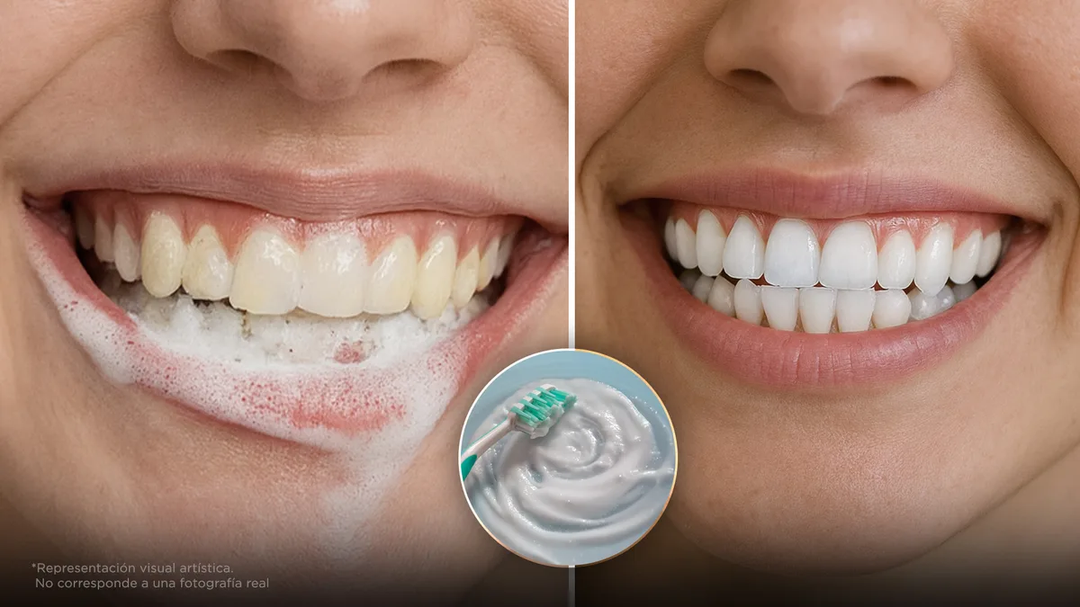 Dentista revela 3 formas naturales de blanquear tus dientes