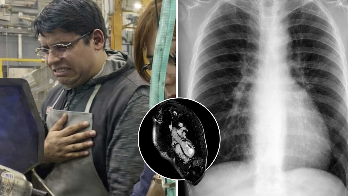 Esto le pasa a tu corazón si tienes mucho estrés en el trabajo