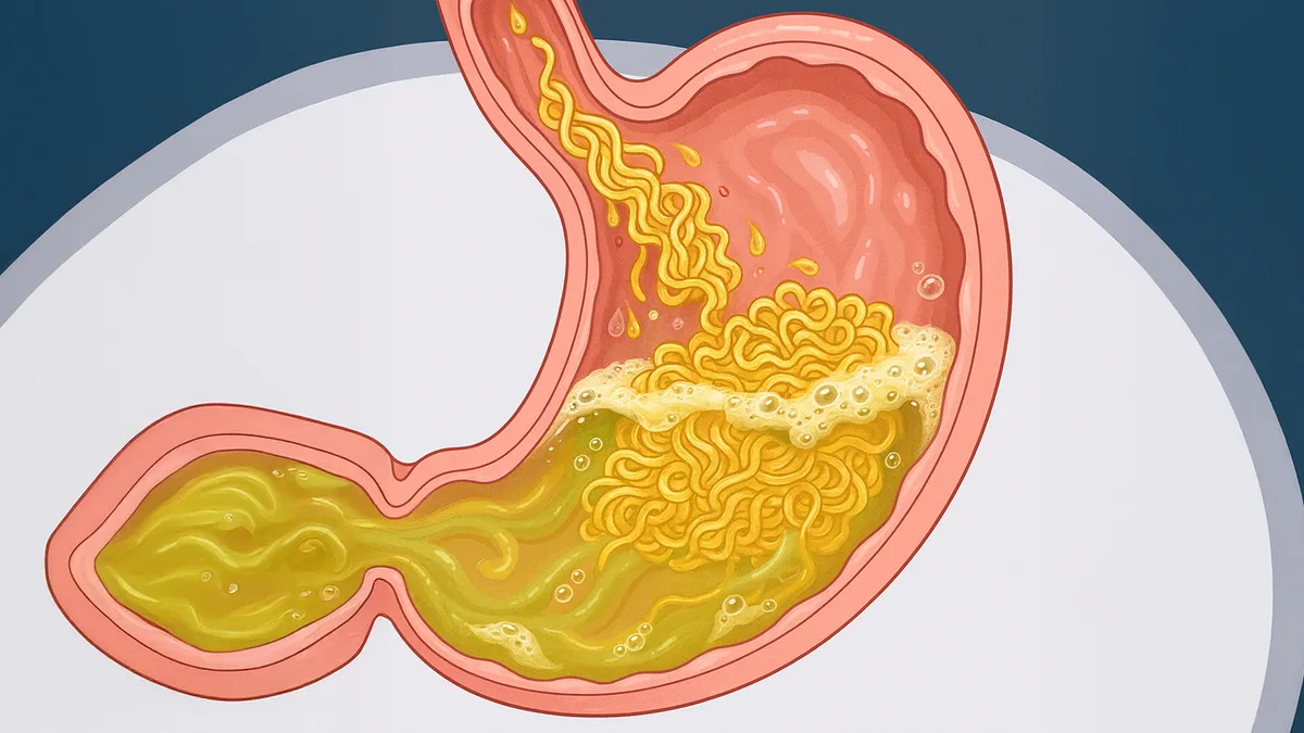 Esto le pasa a tu estómago cuando comes una Maruchan. ¿Dura 1 año dentro?