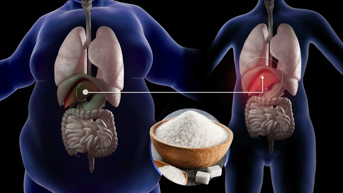 Esto le pasará a tu cuerpo si dejas el azúcar por 4 semanas
