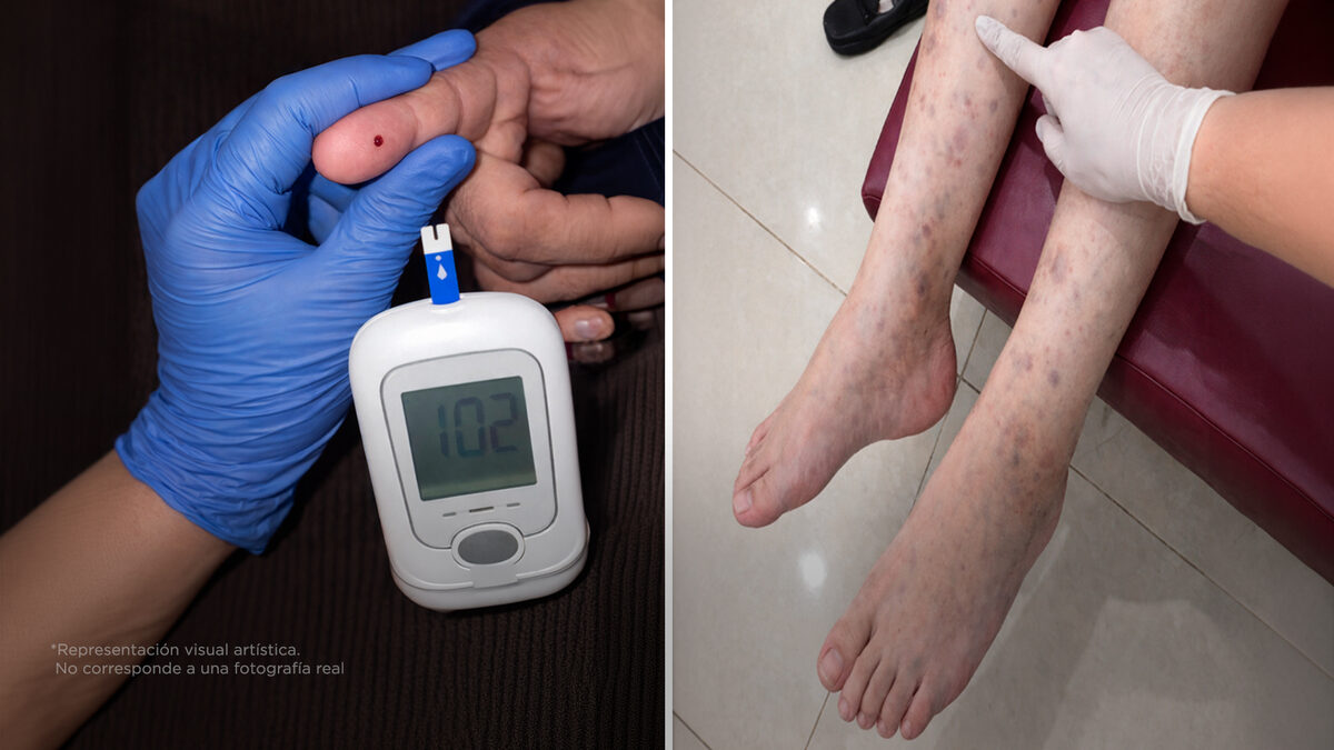 La diabetes no es el final, es el inicio