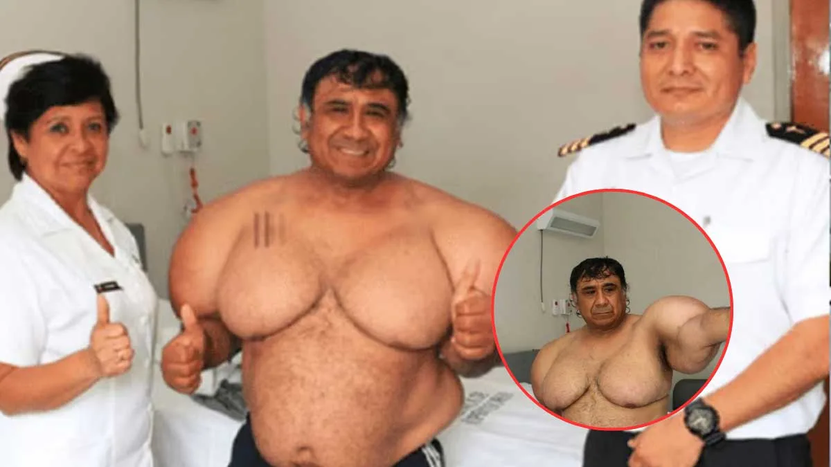 La increíble historia de Alejandro Ramos, el buzo peruano que vive ‘inflado’ tras un accidente
