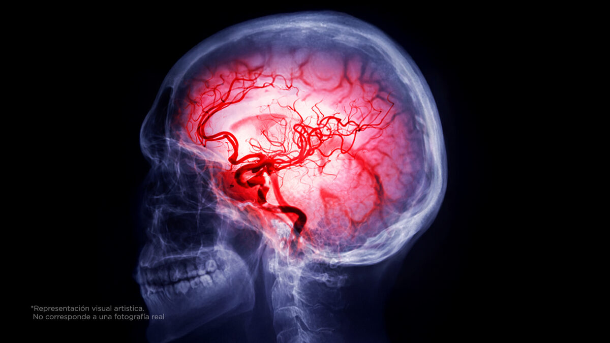 Los 3 alimentos que más dañan tu cerebro (y los comes todos los días)