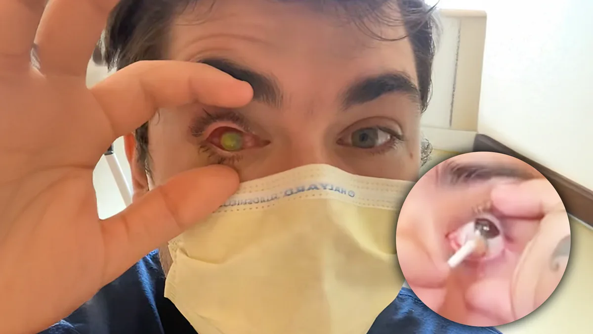 Nunca hagas esto antes de dormir. Casi pierde un ojo