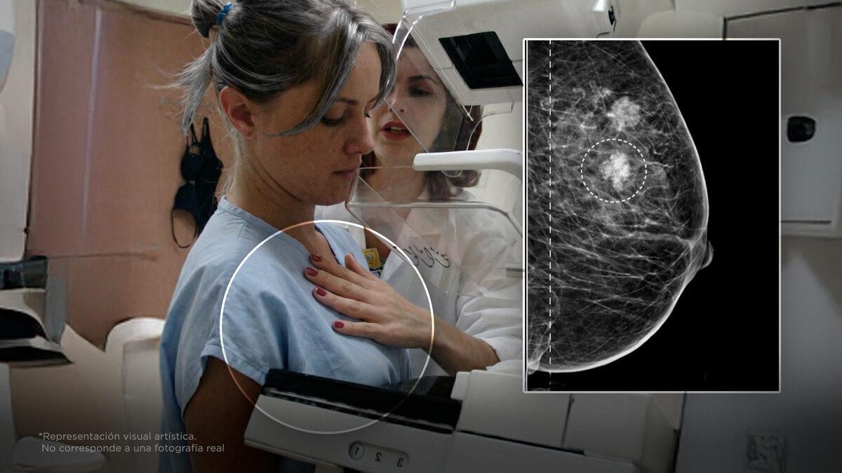 ¿Por qué los casos de cáncer de mama van en aumento?