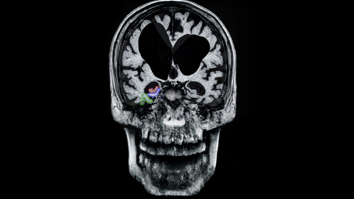 Tu cerebro comienza a fallar no por la edad, sino porque dejas de usarlo