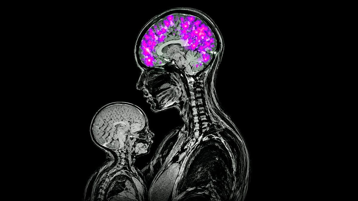 Tu cerebro no vuelve a ser el mismo después de ser mamá, la ciencia lo confirma