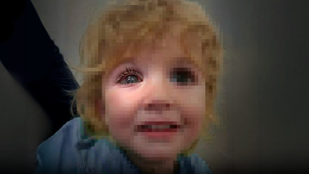 Un niño perdió la vista de un ojo por este error que todos cometemos